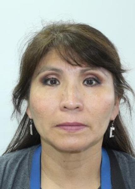 Torres Zevallos Anita