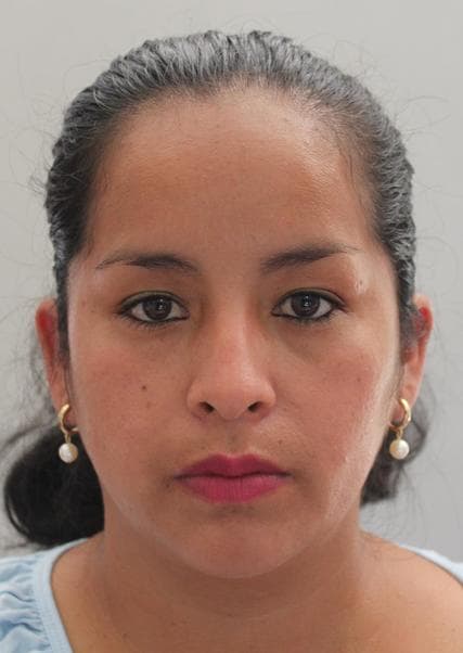 Iñigos Balcon Nelida Gloria