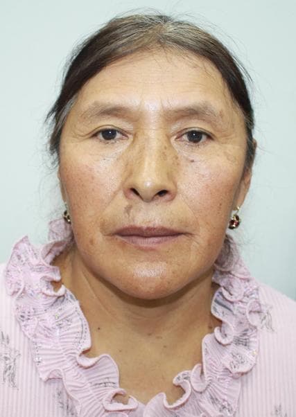 Ccallo Condori Olga Zoraida