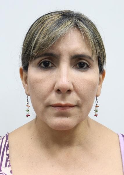 Sanguinetti Guzman Carol Olga