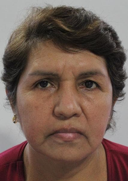 Albagli Vera Matilde Haidee