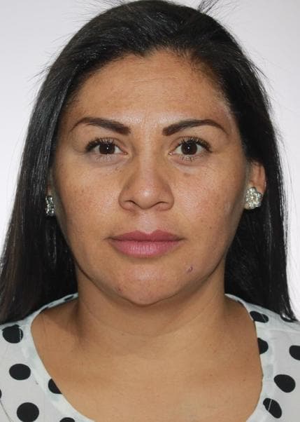 Perochena Ale de Oliva Atsara Linda