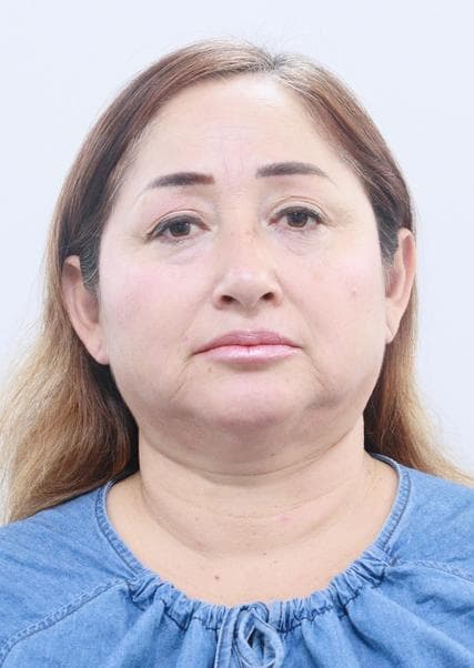 Herrera Yangua de Parra Dady Carol