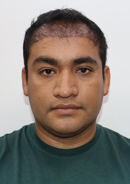 Toribio Castro Giancarlo Andre